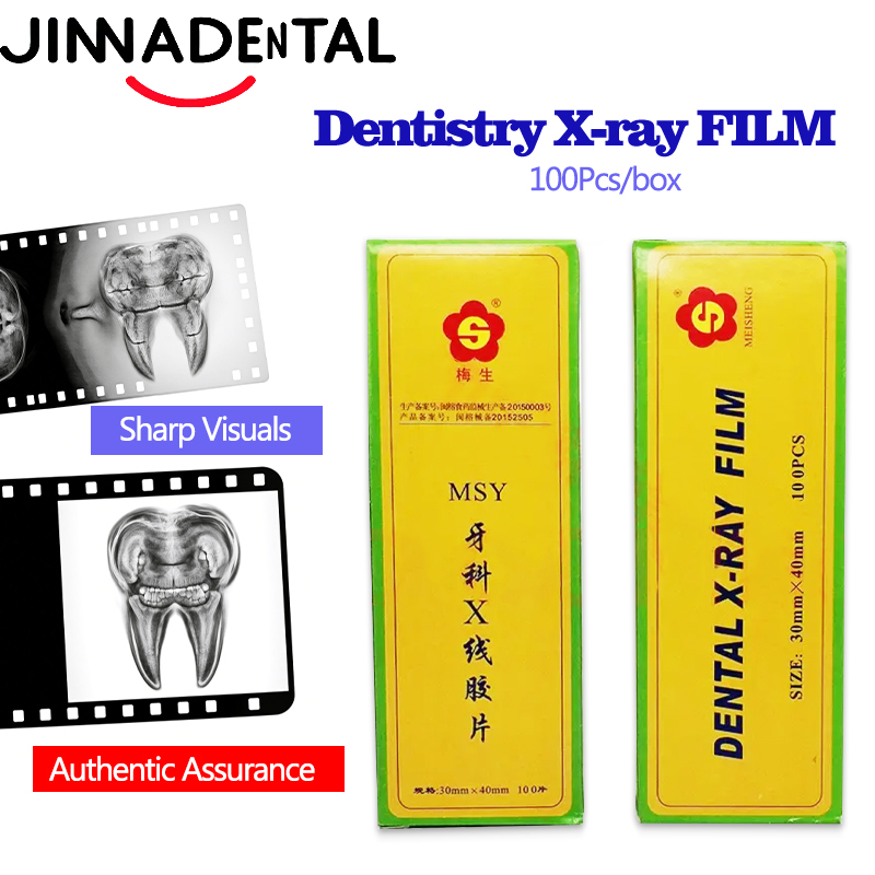 X Medical Lab - Films radiographiques dentaires 30*40mm pour la